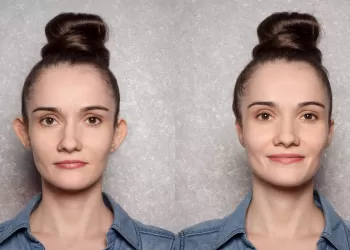 Kepçe Kulak Cerrahisi Nasıl Olur?