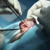 Kulak Ameliyati Fotograf