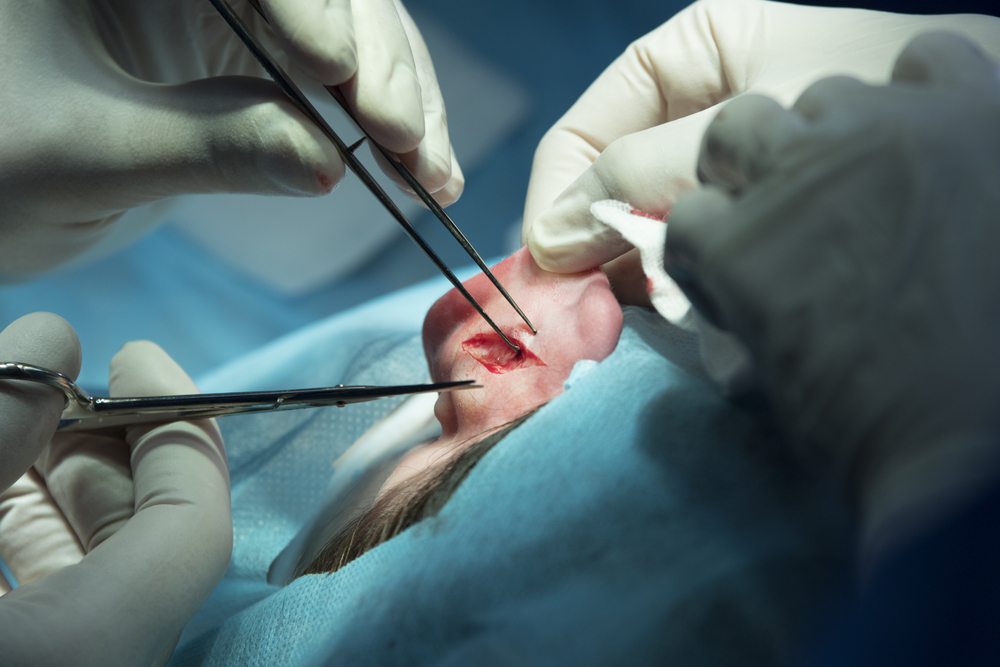 Kulak Ameliyati Fotograf