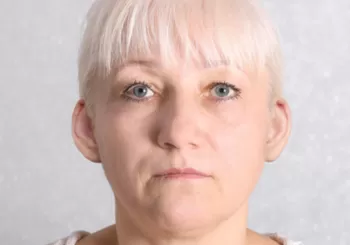 Kulak Cerrahisi Oncesi