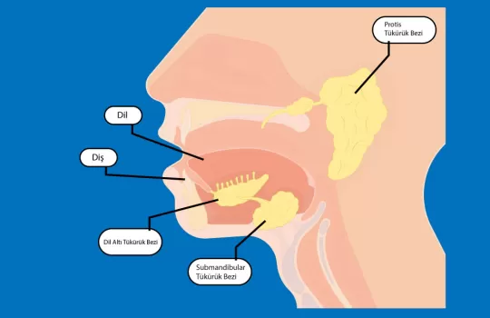 Parotis Tumoru Cerrahisi 8