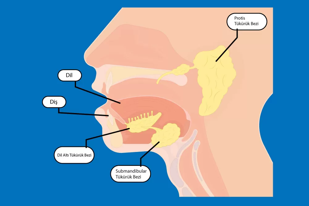 Parotis Tumoru Cerrahisi 9